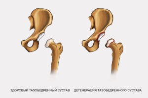 Ортез бедра с термотерапией Reh4Mat Am-sb-03