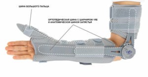 Одношинный ортез локтя OKG-16